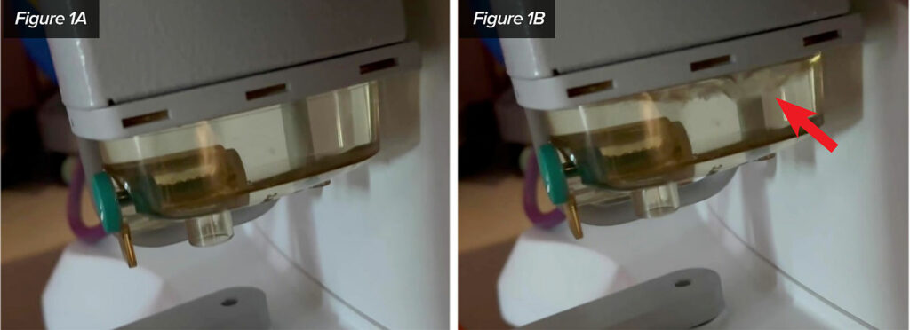 Figure 1: Exhibit A and B demonstrating the full condenser reservoir undisturbed (A) and the same condenser reservoir when shaken (B).