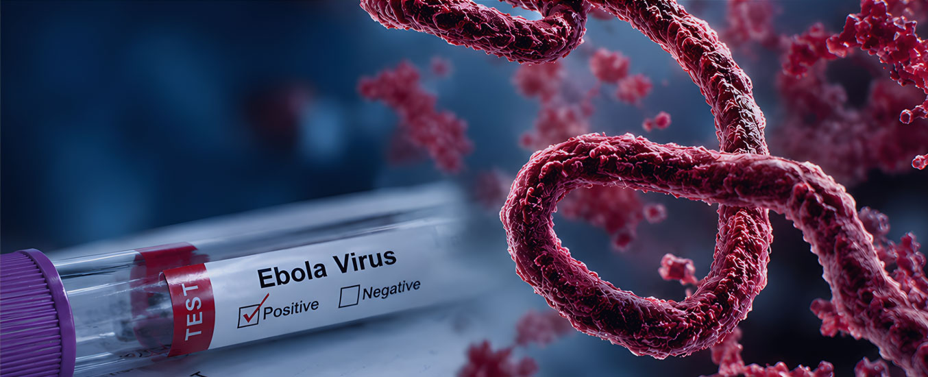Ebola and the Anesthesia Professional: Practical Considerations During the Current Bundibugyo Virus Outbreak