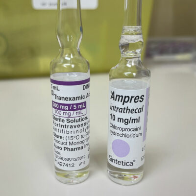 Tranexamic Acid, Chloroprocaine Hydrochloride