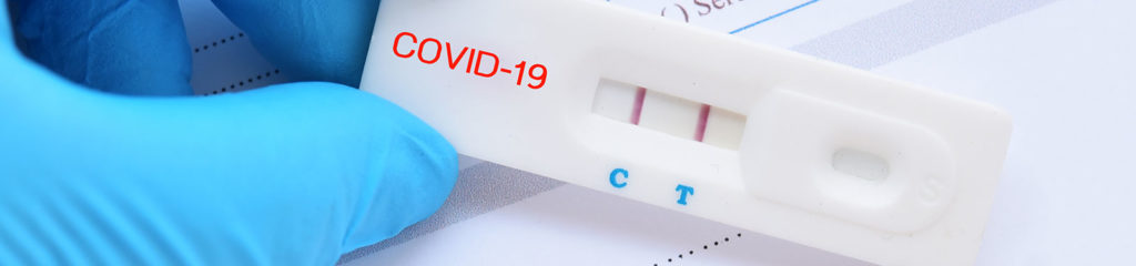 COVID-19 Test