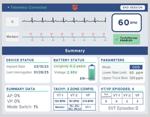 New from the APSF Technology Education Initiative: Cardiac Implantable Electronic Devices (CIED)