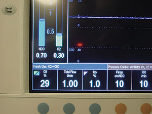 electronic metering