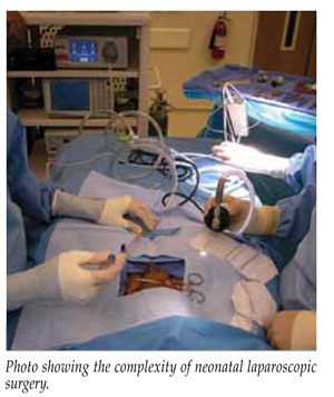 laparoscopy