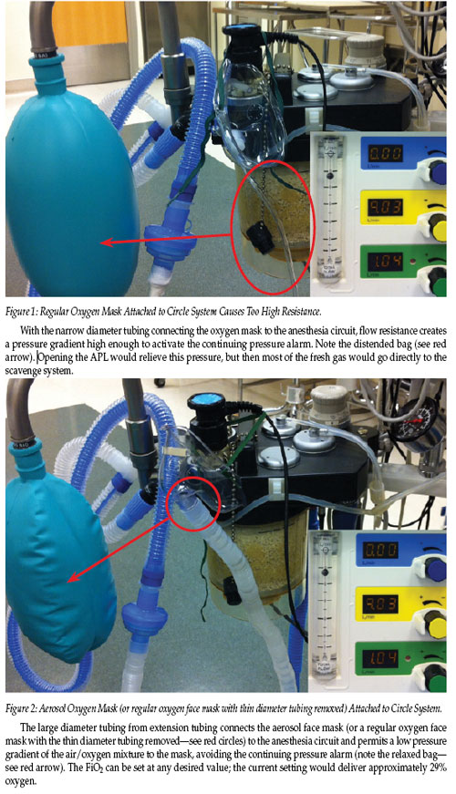 Circuits