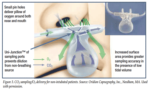 Waveform capnography in the intubated patient - EMCrit Project