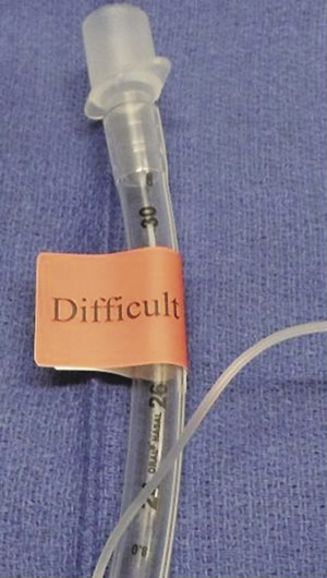 Difficult Airway sticker