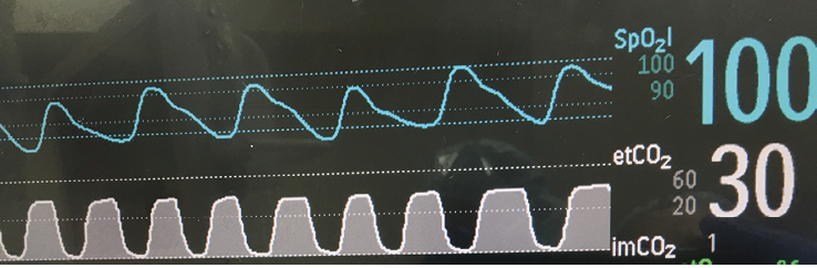 gap in pediatric mask