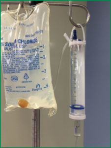 Figure 1. Burette perpendicular to floor with 500 mL NS Bag.