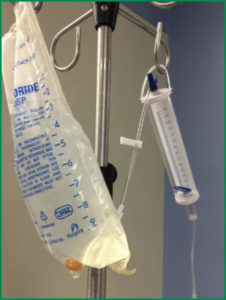 Figure 2. Burette angled to floor with 1000 mL NS Bag.