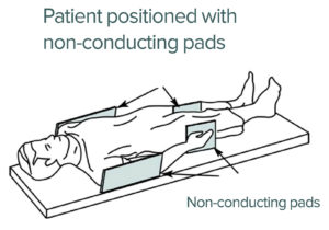 Figure 2. Depicts where nonconducting pads can be placed to reduce the risk of MRI-related burn. Figure 2 is an extract from a GE Healthcare MRI Operator Manual addressing patient padding. Reproduced and modified with permission from GE Healthcare.