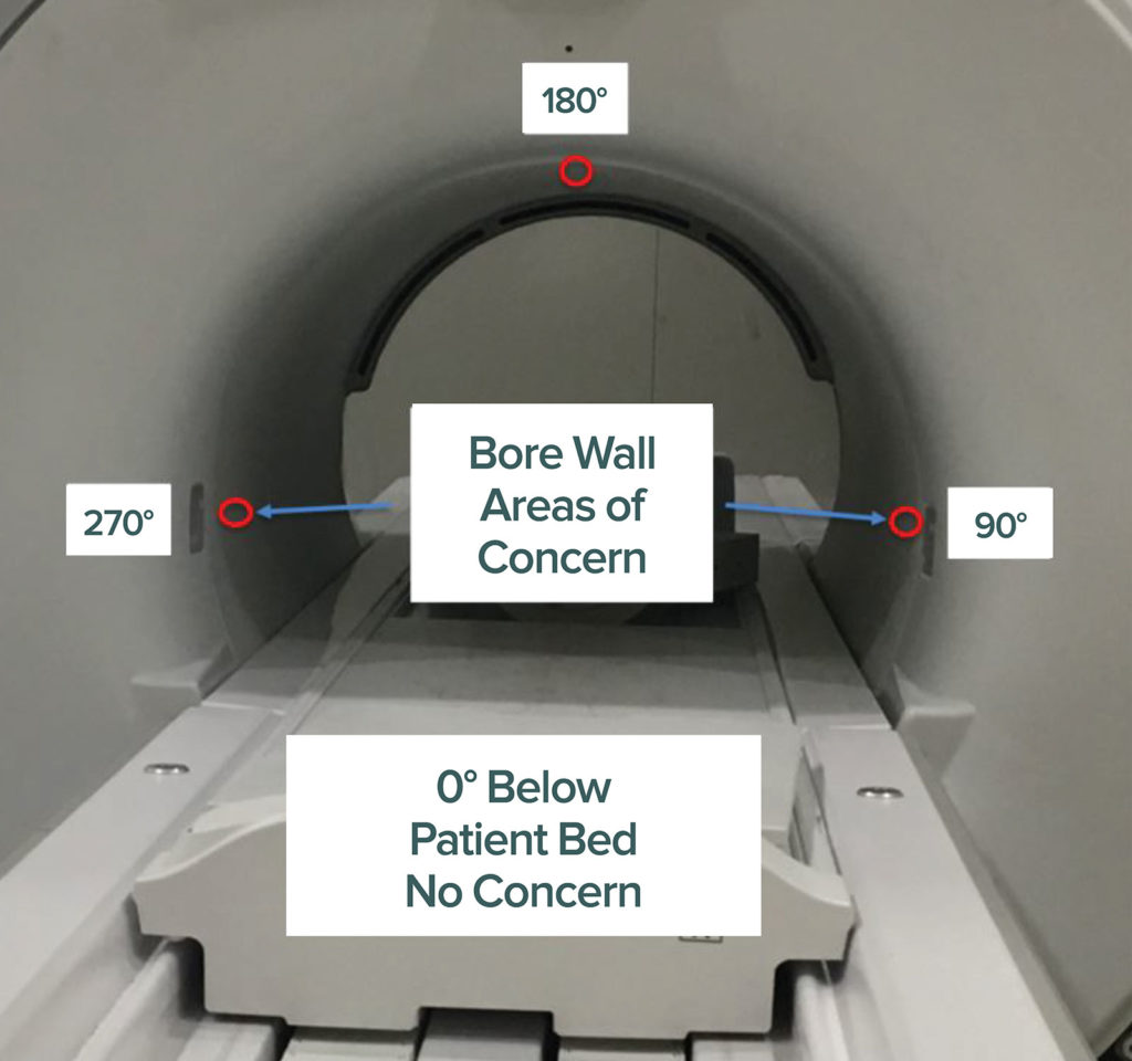 Figure 3. Depicts the particular areas where patients may be at increased risk for burn in MRI.<br /> Reproduced and modified with permission from GE Healthcare.