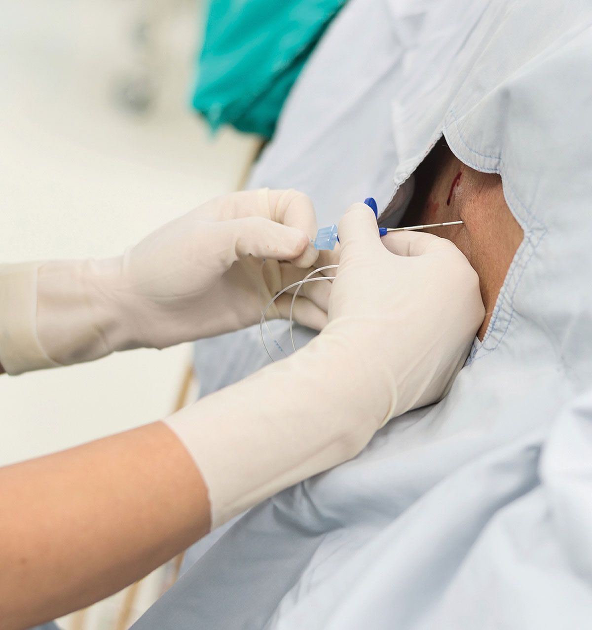 A Bad System Will Beat A Good Person Every Time Anesthesia Patient