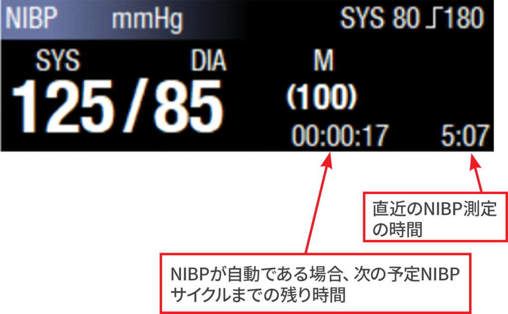 図5：NIBPのタイムスタンプと次のサイクルまでのカウントダウン。