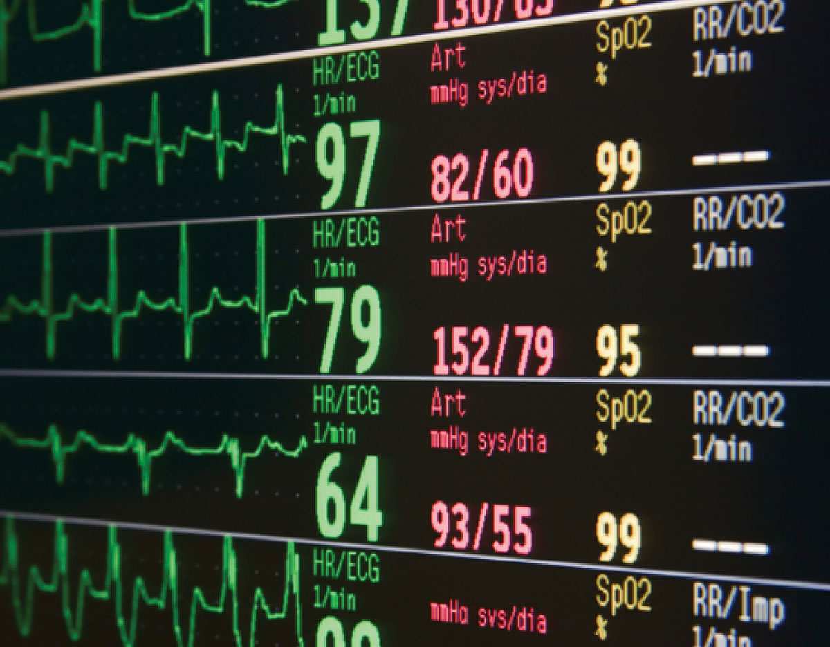 Alarm Fatigue and Patient Safety Anesthesia Patient Safety Foundation