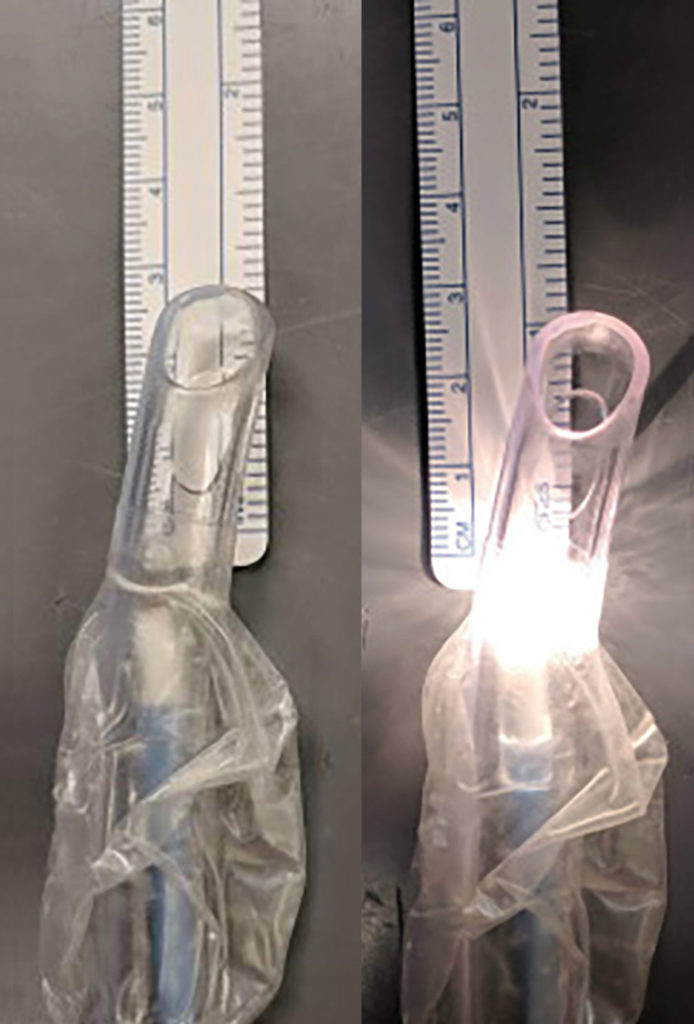 Figure 2: Size 8.5 mm endotracheal tube with the Vital Signs® Orotracheal Lighted Stylets (CareFusion) and light turned on and off. The lighted stylet falls approximately 2-3 cm short of the length required for appropriate positioning at the endotracheal tube tip.