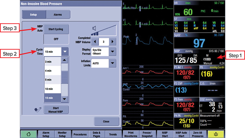 Figure 2: "General Electric (GE) CARESCAPE B-850" NIBP automatic cycle configuration.