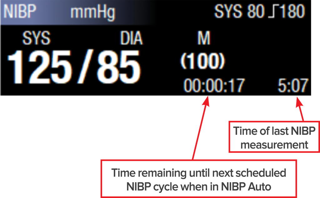 Figure 5: NIBP time stamp and countdown until next cycle.