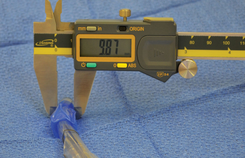 Figure 2: Example of a Shiley 37 Fr Left DLT endobronchial measurement (in mm, this important endo-bronchial diameter is not indicated on the packaging, see Fig. 1).