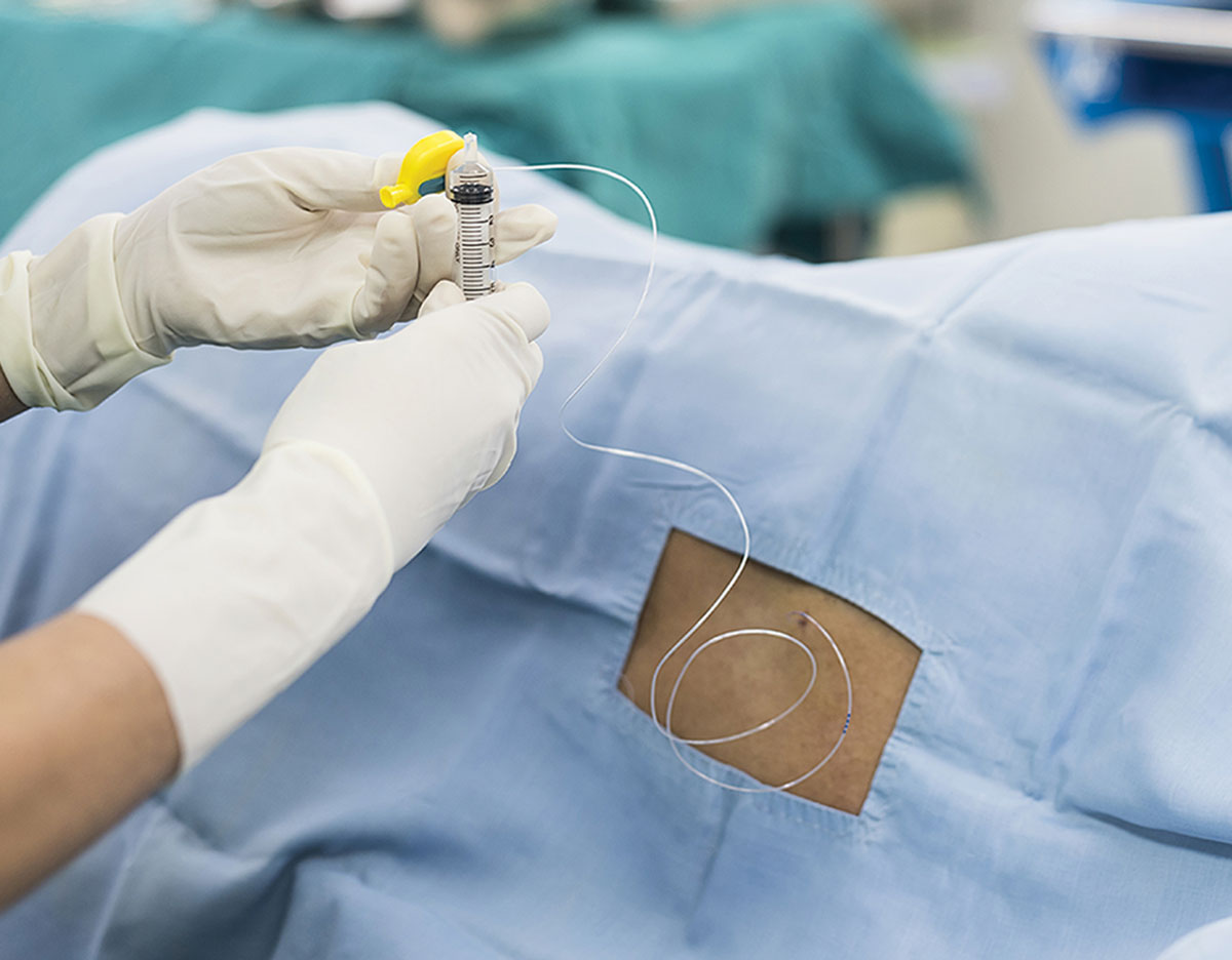 PRO and CON Using a Labor Epidural for Cesarean Delivery PRO Dose