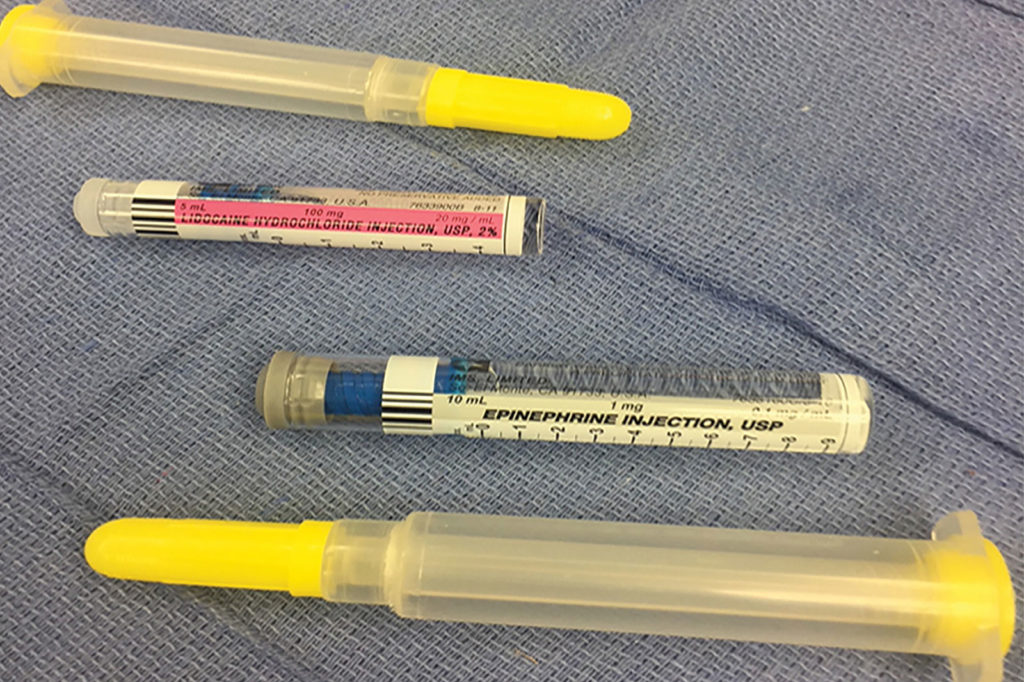 Figura 1A: Describe la etiqueta frontal de las jeringas de lidocaine (lidocaína) al 2 % y de epinephrine (epinefrina) de 0,1 mg/ml.