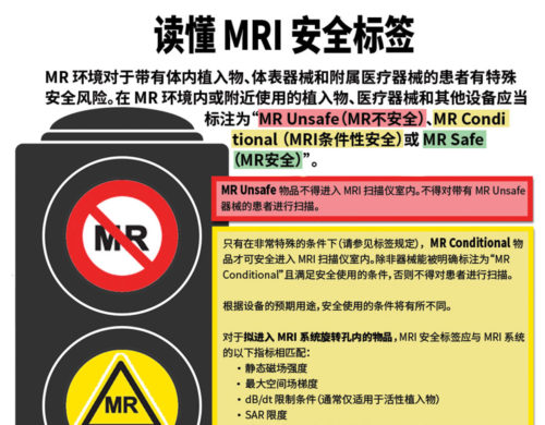 磁共振成像 (MRI) 室内的气道紧急情况和安全性