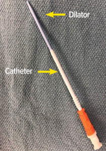 Figure 1: Depicts an 8 French Rapid Infusion Catheter with the dilator (blue) in situ.