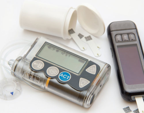 Glucose Monitoring