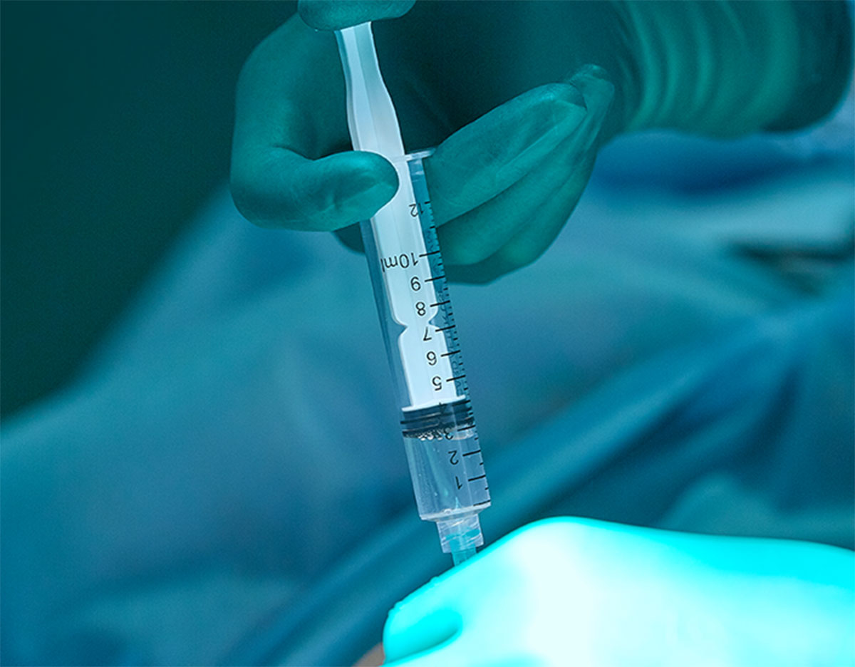 La toxicité systémique des anesthésiques locaux (TSAL) revisitée un