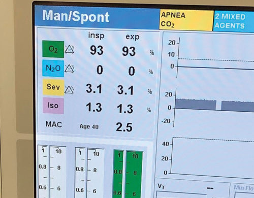 Dräger gas analyzer display showing both isoflurane and sevoflurane delivery when using an incorrectly filled sevoflurane vaporizer