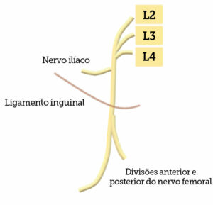 Figura 1. Ilustração do nervo femoral passando abaixo do ligamento inguinal e do nervo ilíaco se ramificando mais proximal ao ligamento inguinal.