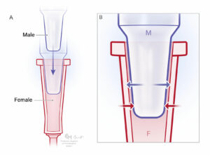 Figure 1: A) Male and female Luer taper connectors unengaged. B) Luer Taper connectors engaged to form a leak-free connection. Arrows indicate compressive forces between the inner and outer walls of the taper. The connection is secured by the combination of compressive forces and friction between the contact surfaces. Note that dry connections are typically less likely to disconnect than when the taper surfaces are wet.