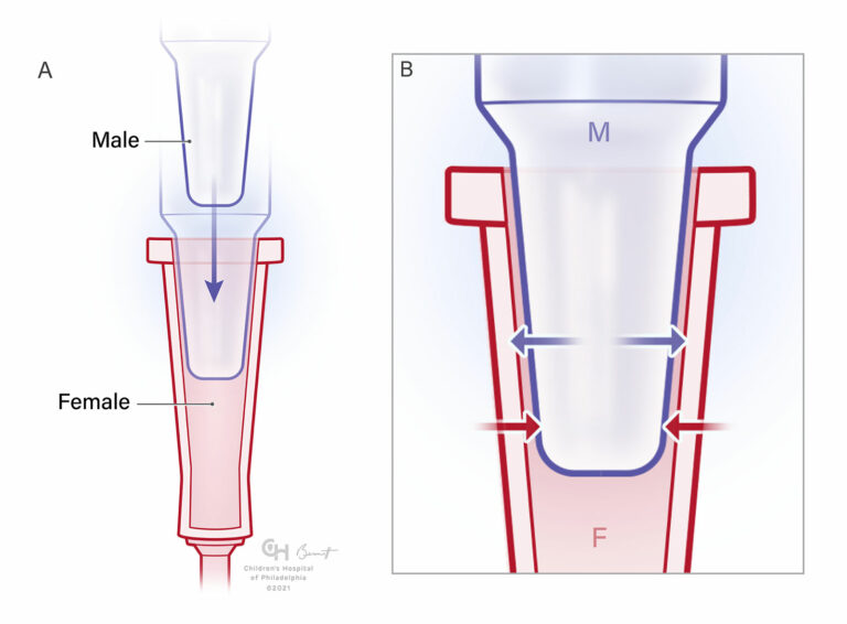 Managing Luer Connections Anesthesia Patient Safety Foundation