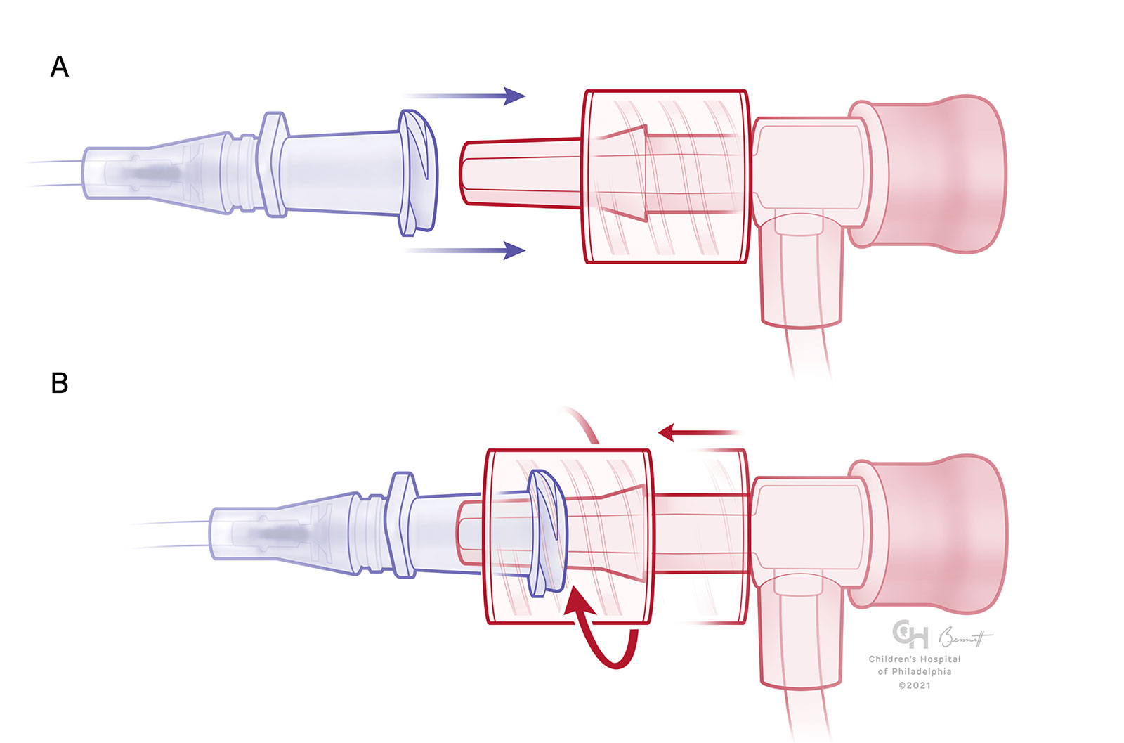 Managing Luer Connections - Anesthesia Patient Safety Foundation