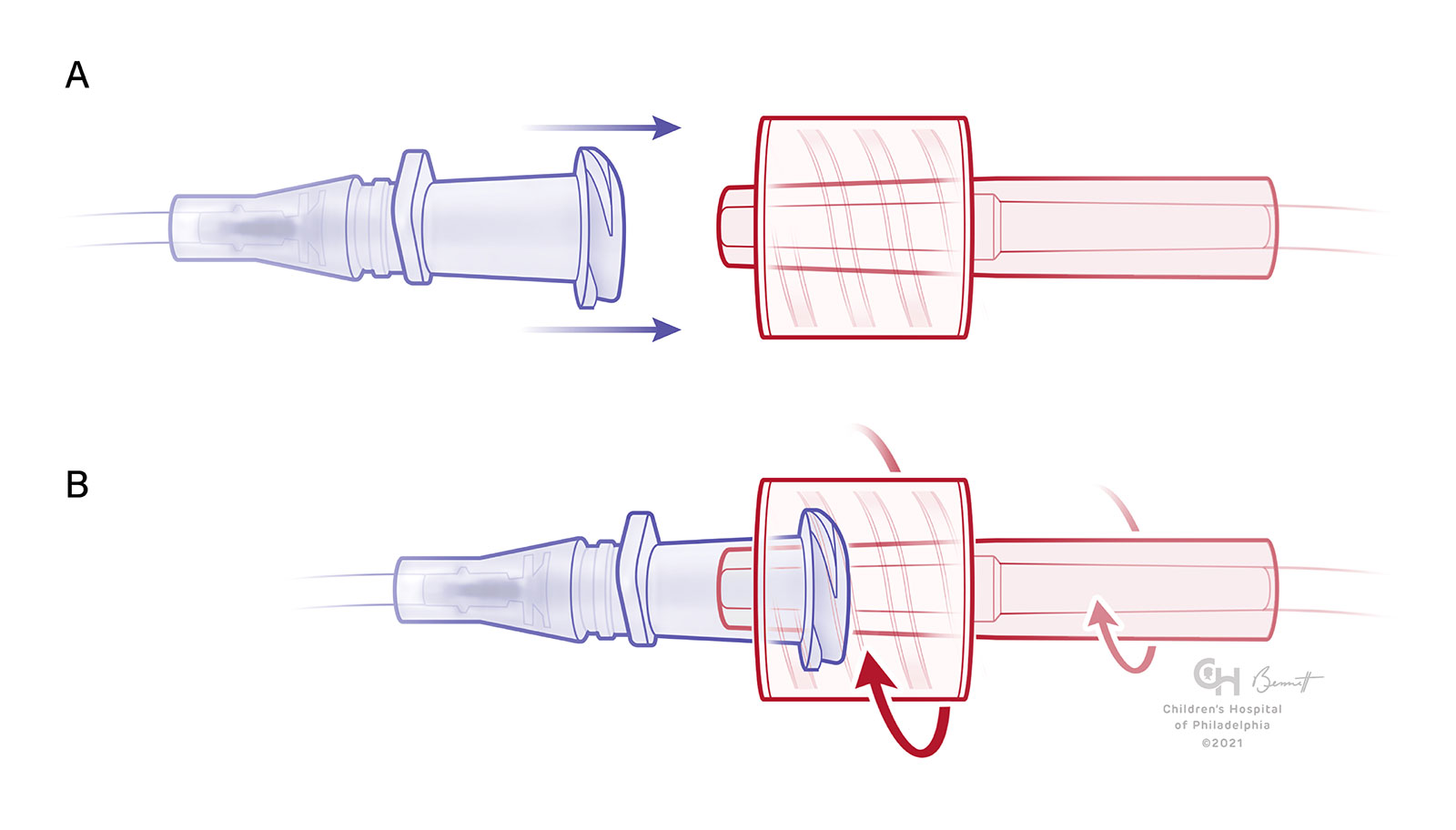 Embout Luer lock femelle/femelle stérile : : Commerce, Industrie  et Science