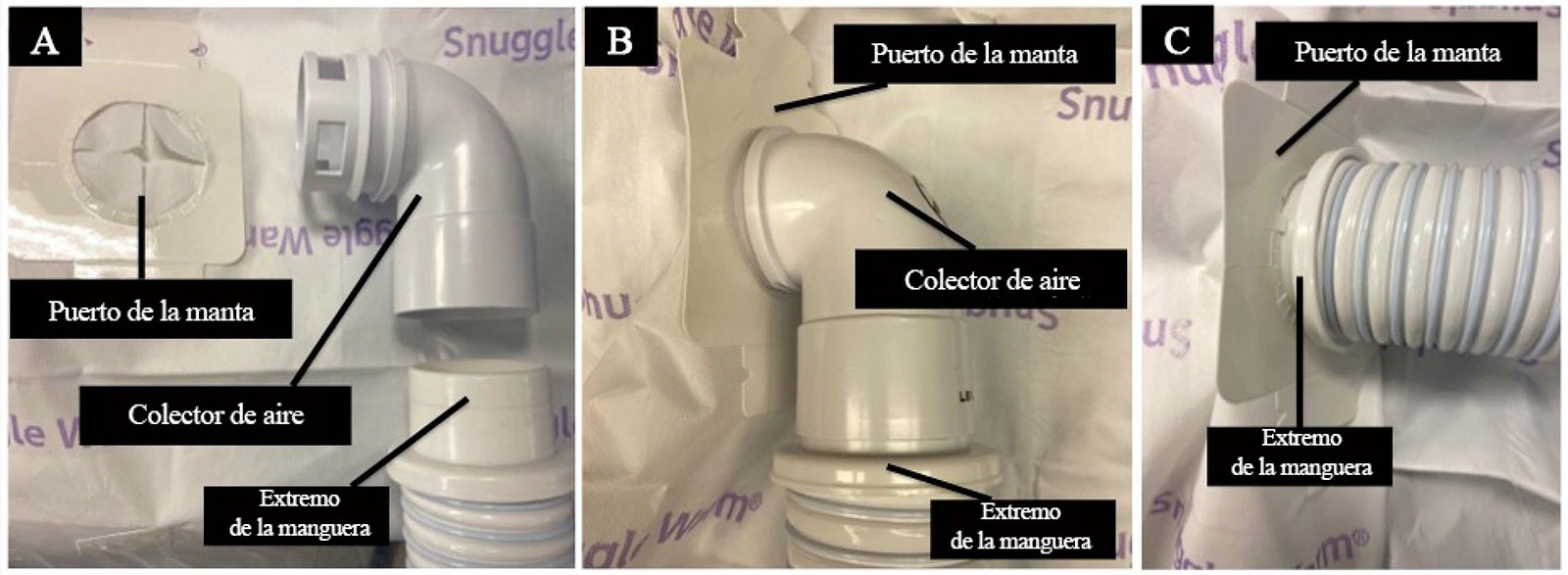 Manejo perioperatorio de la ingesta de pilas de botón en niños - Anesthesia  Patient Safety Foundation