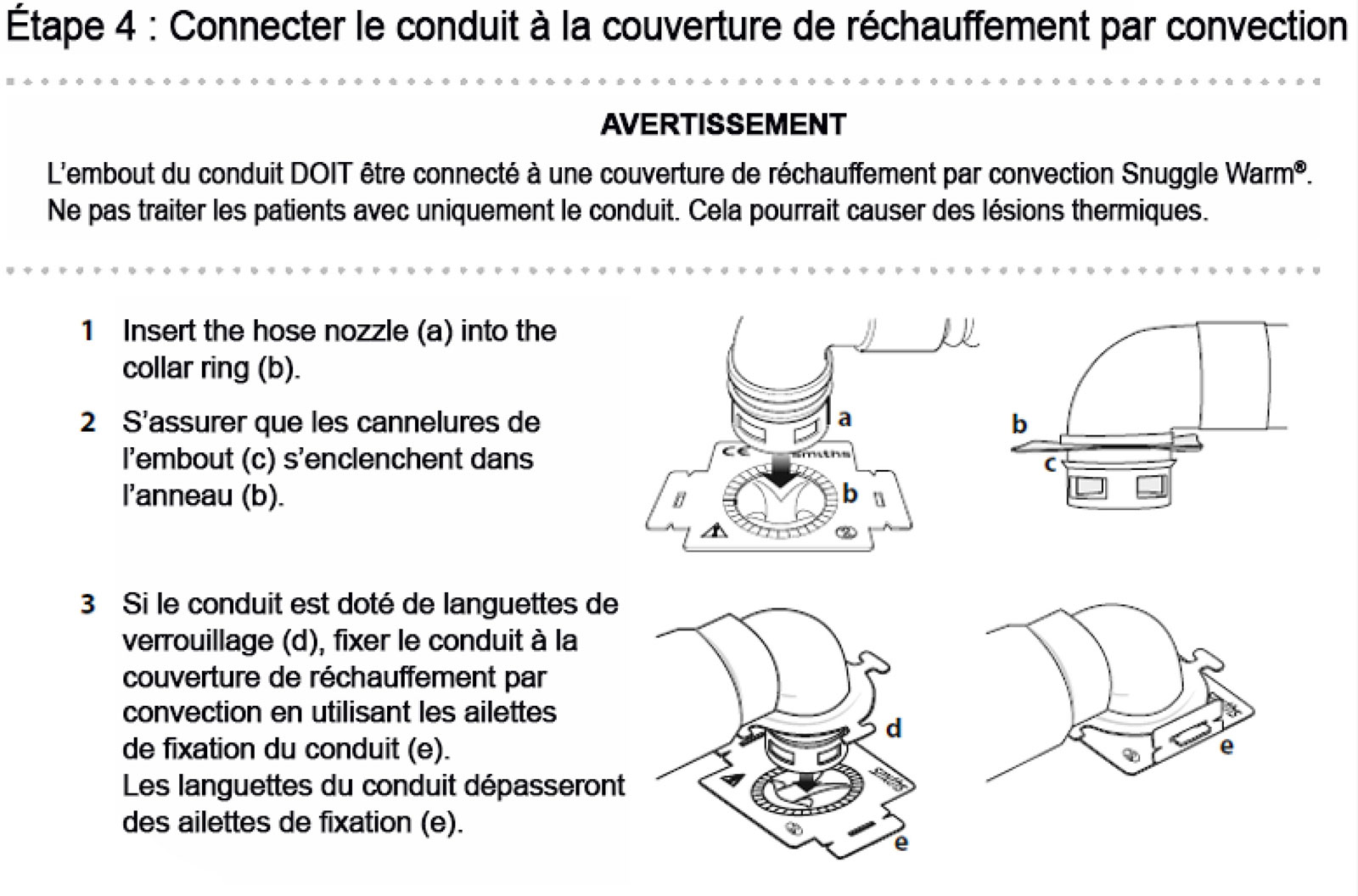 Gestion périopératoire de l'ingestion de piles boutons par les