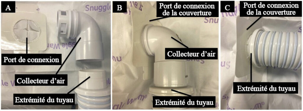 Figure 2 : L’image A représente l’extrémité du conduit démonté du collecteur d’air. Il convient de noter les perforations à l’extrémité distale du collecteur d’air, qui distribuent le flux d’air à travers la couverture chauffante. L’image B représente la connexion correcte de l’extrémité du conduit sur le collecteur d’air, qui se connecte ensuite sur le port de la couverture. L’image C représente la manière d’insérer (accidentellement) l’extrémité du conduit directement dans le port de la couverture si le collecteur d’air est absent.