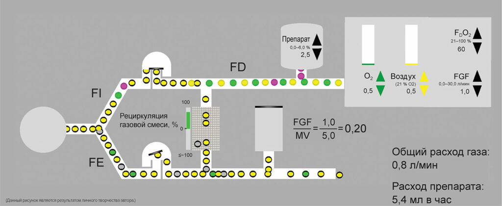 Рисунок 1: Идеальная схема контура, где объем свежей газовой смеси представляет собой минутный объем вентиляции легких при скорости подачи воздуха 1 л/мин, в том числе кислорода - 0,5 л/мин. Воздух - желтые круги, Кислород - зеленые круги, Действующее вещество - фиолетовые круги. Круги с черной каймой = выдыхаемый газ или анестетик, часть которого возвращается во вдыхаемую часть. Следует отметить, что вследствие рециркуляции выдыхаемых газов концентрация кислорода и анестетика в потоке поступающего газа (F D O 2 60% и F D A 2,5%) будет отличаться от концентрации во вдыхаемом воздухе (F I O 2 и F I A) из-за смешивания поступающего газа с выдыхаемым (F E O 2 и F E A). Точные различия концентраций будут зависеть от этапа процедуры, при этом разница будет уменьшаться со временем. F D - доставленная фракция, F I – фракция на вдохе; F E – фракция на выдохе; F G F - поток свежей газовой смеси; М В - минутный объем вентиляции легких.