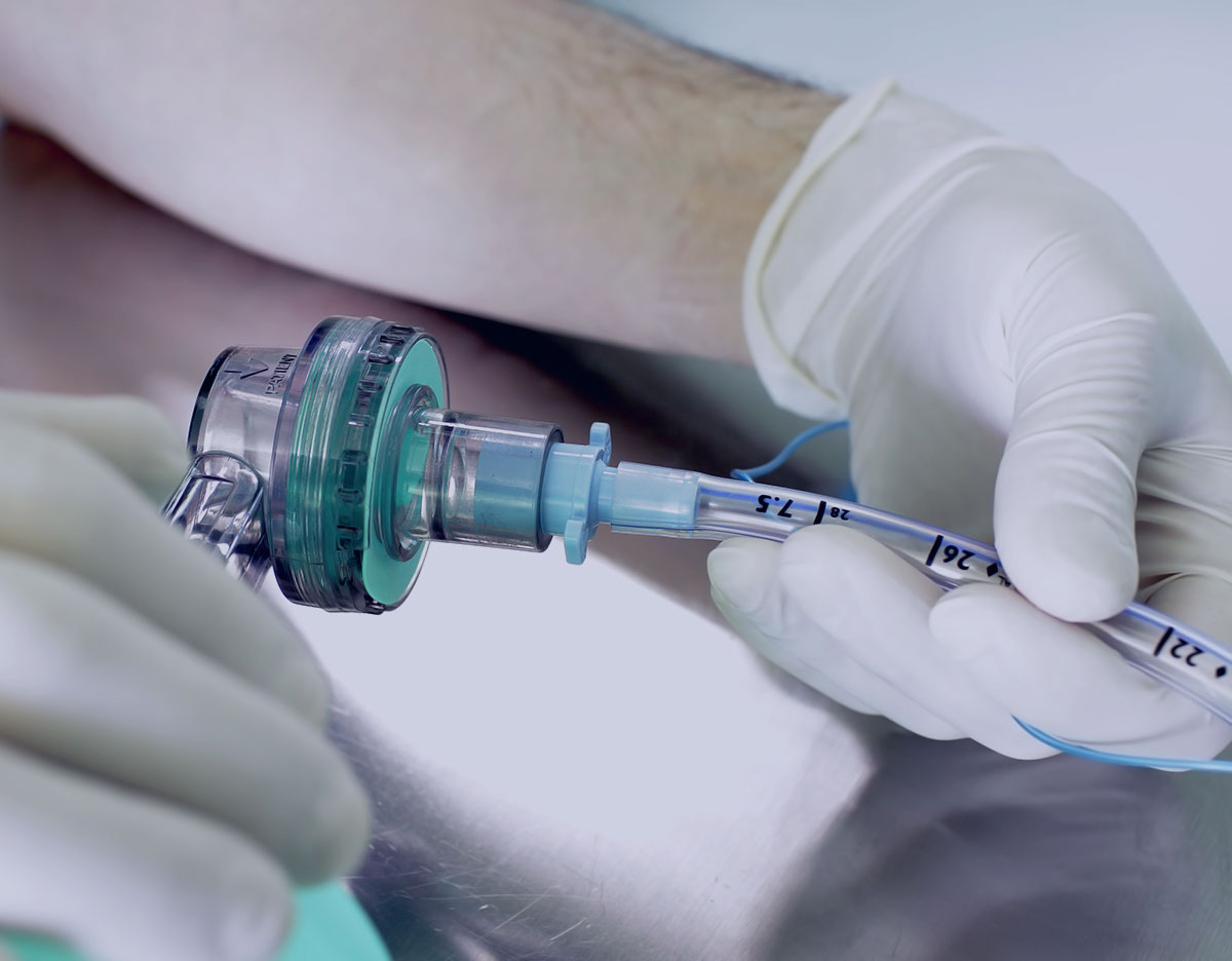 Unplanned Extubation in the Perioperative Environment Anesthesia
