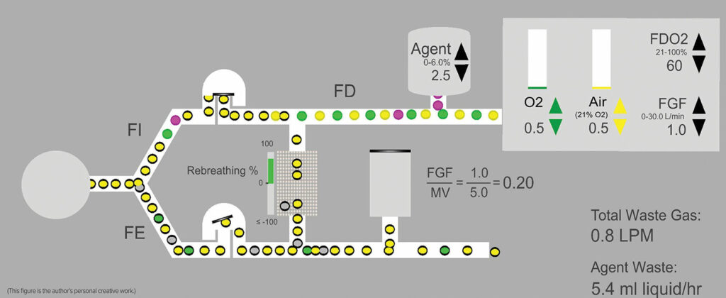 Figure 1: Idealized schematic of a circle system where FGF is a fraction of the minute ventilation at 1 L/min—0.5 L/min Air and O2 respectively. Air = Yellow circles, Oxygen = Green circles, and Agent = purple circles. Circles with the black border = exhaled gases or anesthetic, some of which return to the inspired limb. Note that due to recirculation of exhaled gases, the concentration of oxygen and anesthetic delivered in the fresh gas flow (FDO2 60% and FDA 2.5%) will be different from the inspired concentrations (FIO2 and FIA) due to mixing of fresh gas with exhaled gases (FEO2 and FEA). The exact concentration differences will depend upon the phase of the procedure with the difference diminishing over time. FD = delivered fraction, FI = inspired fraction; FE = expired fraction; FGF = fresh gas flow; MV = minute ventilation.