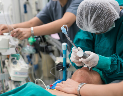 Anesthesia Intubation