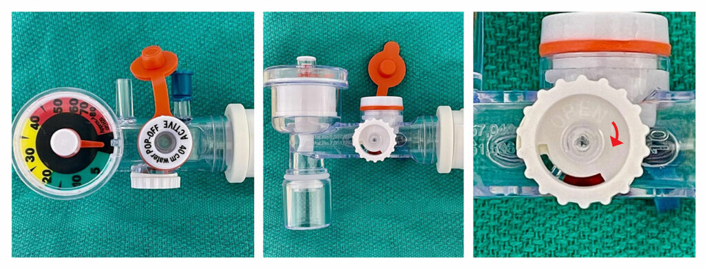 Рисунок 1: Несколько изображений системы гиперинфляции SunMed Ventlab (модель HS4011, Ventlab, LLC; г. Гранд-Рапидс, шт. Мичиган), на которых обращается внимание на регулируемый клапан давления. Обратите внимание, что белый текст на белом пластике трудно прочитать. Стрелка по часовой стрелке обозначается как Open («Открыть») — это противоположно тому, что обычно ожидается (вращение по часовой стрелке обычно приводит к закрытию клапана).