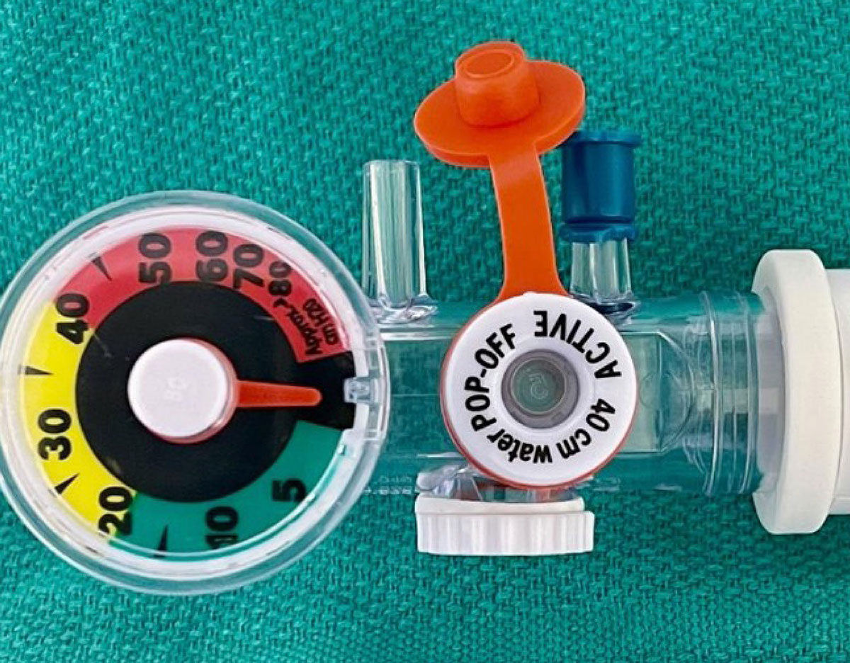 Transportation of Pediatric Patients With Hyperinflation System