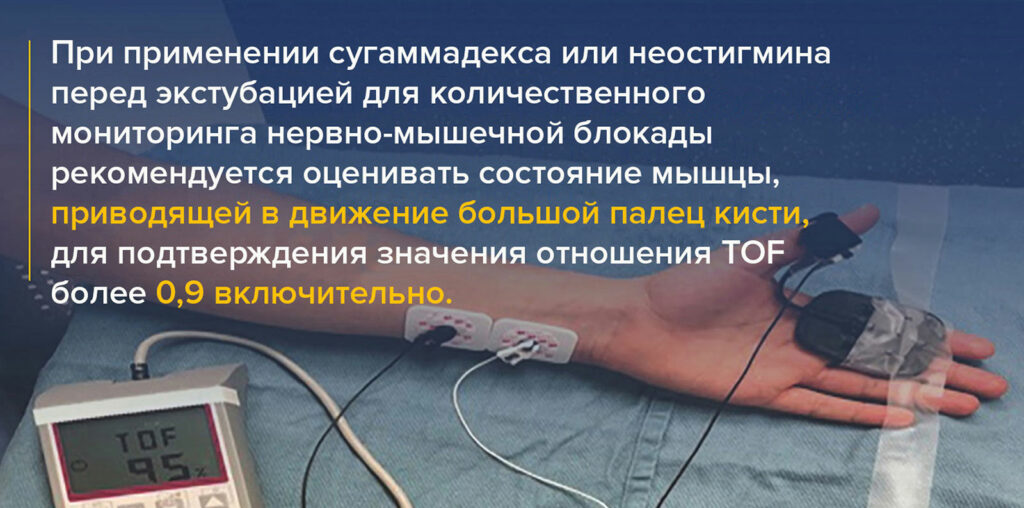 Количественный мониторинг нервно-мышечной блокады