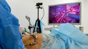 Laparoscopic Surgery