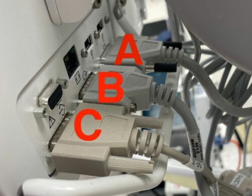 Figure 1: Cable A: System Power Interface; Cable B: System Signal Interface; Cable C: Serial Port – standard interface for external communication to electronic health record.