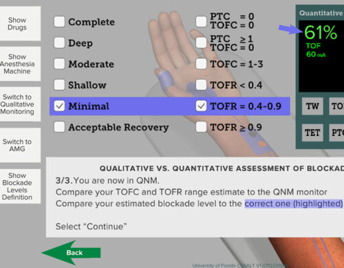 Quantitative Neuromuscular Monitoring Simulation