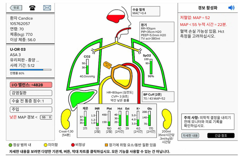 그림2. “Alert-Watch OR”의 프로토타입 샘플 모니터/알림/의사 결정 지원 화면<sup>18</sup>