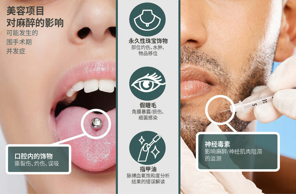 美容项目对麻醉的影响