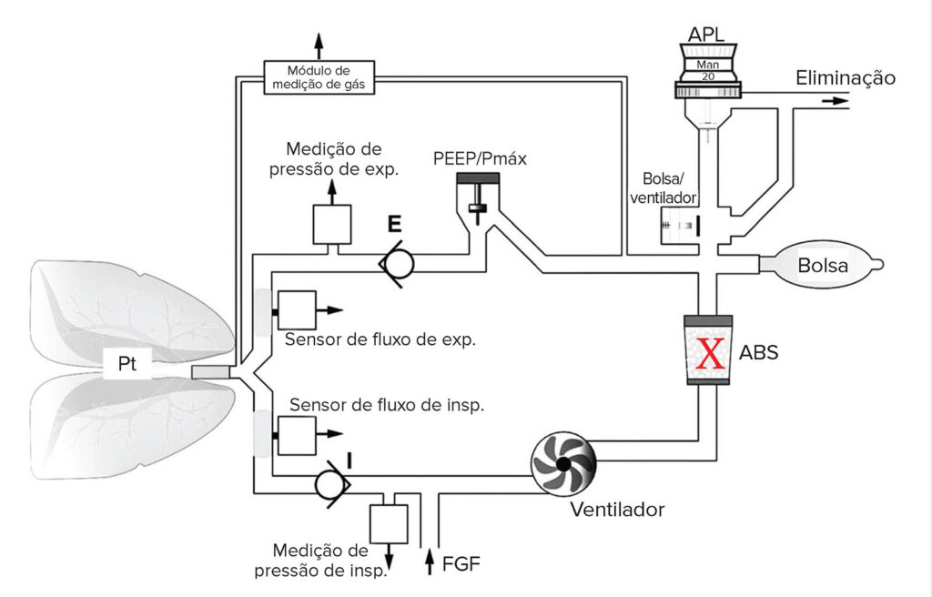 Figura 2: Esquema do circuito de respiração do tipo turbina da Dräger (Perseus) com o local do vazamento indicado com um X. A inspiração mecânica continuará se houver um vazamento no recipiente, embora o ar ambiente possa ser transportado, alterando a concentração de gases no circuito. Durante a expiração, o gás exalado e o gás fresco continuarão a encher a bolsa. A ventilação manual pode ser difícil ou impossível, dependendo do tamanho do vazamento. (Cortesia Dräger Medical.) <br /><br />
ABS = Recipiente absorvente; FGF = Fluxo de gás fresco; APL = Limite de pressão ajustável.